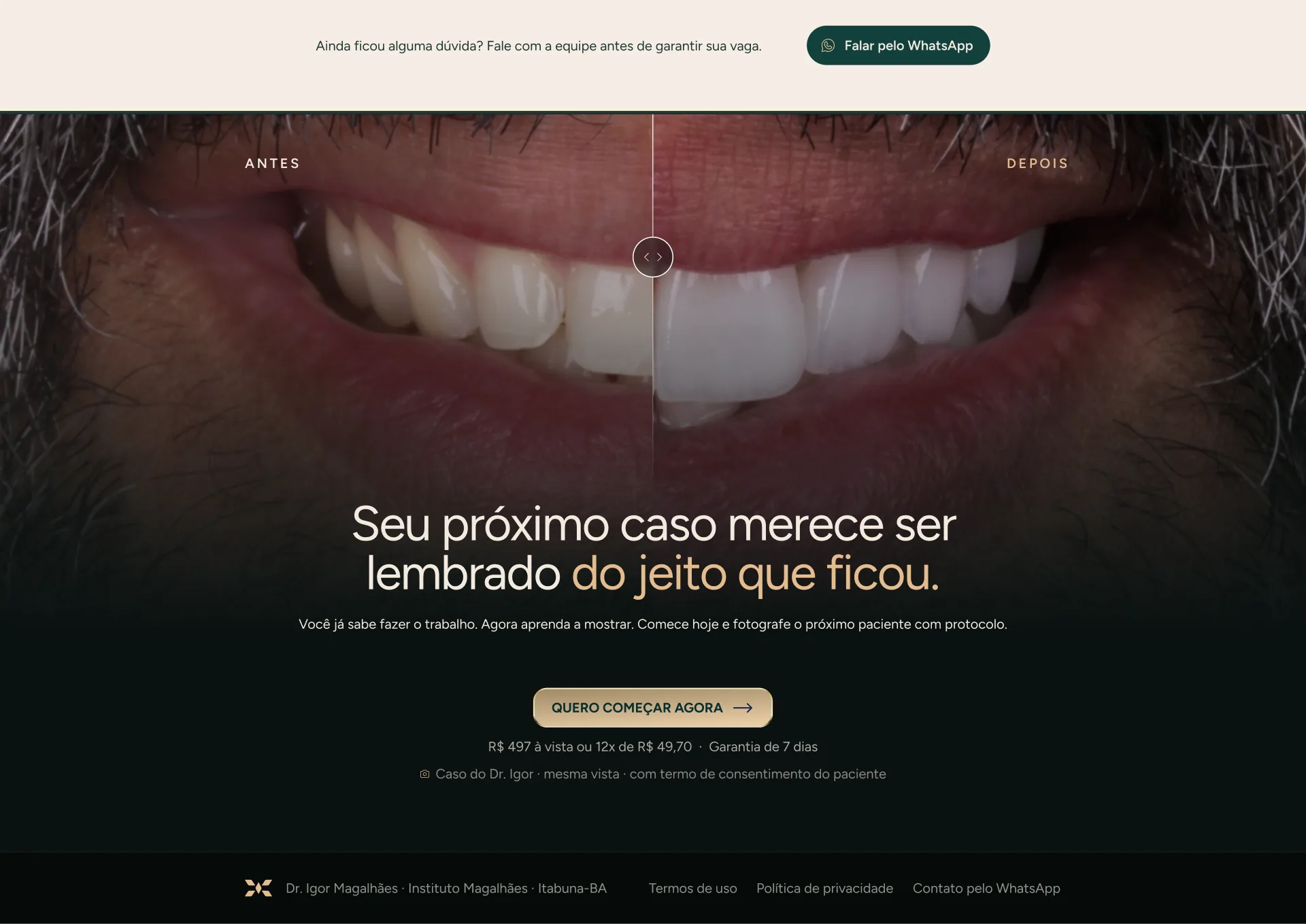 Antes e depois de um caso do Dr. Igor. Seu próximo caso merece ser lembrado do jeito que ficou. R$ 497 à vista ou 12x de R$ 49,70, garantia de 7 dias.